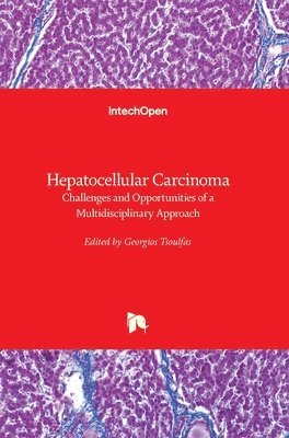 Georgios Tsoulfas - Hepatocellular Carcinoma, Inbunden