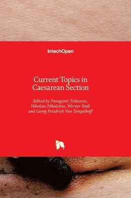 Georg Friedrich Von Tempelhoff, Werner Rath, Nikolaos Nikolettos, Panagiotis Tsikouras - Current Topics in Caesarean Section, Inbunden
