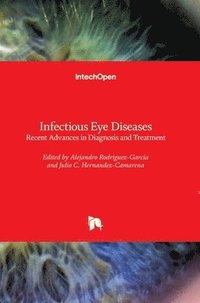 bokomslag Infectious Eye Diseases