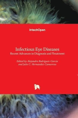 Alejandro Rodriguez-Garcia, Julio C. Hernandez-Camarena - Infectious Eye Diseases, Inbunden