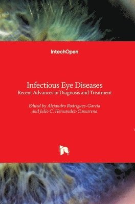 Infectious Eye Diseases 1