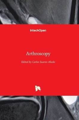 Arthroscopy 1