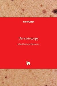 bokomslag Dermatoscopy