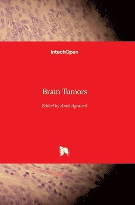 Amit Agrawal - Brain Tumors, Inbunden