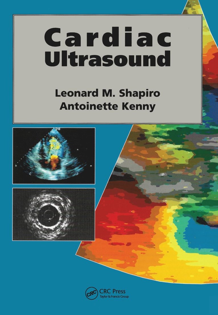 Cardiac Ultrasound 1