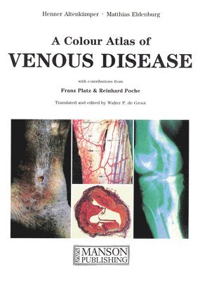 Colour atlas of venous disease, Pocket