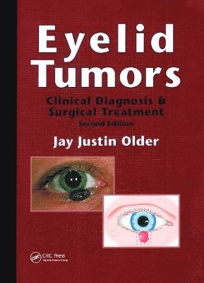 bokomslag Eyelid Tumors