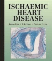 bokomslag Ischemic Heart Disease