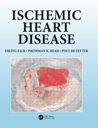 bokomslag Ischemic Heart Disease