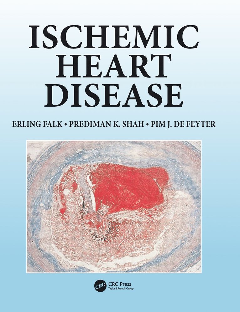 Ischemic Heart Disease 1