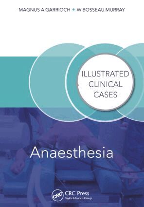 Magnus Garrioch, Bosseau Murray - Anaesthesia, Häftad