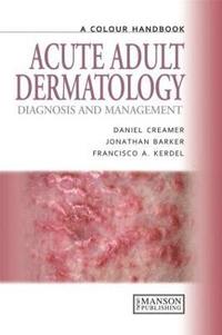 bokomslag Acute Adult Dermatology