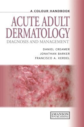 Daniel Creamer, Jonathan Barker, Francisco A. Kerdel - Acute Adult Dermatology, Häftad