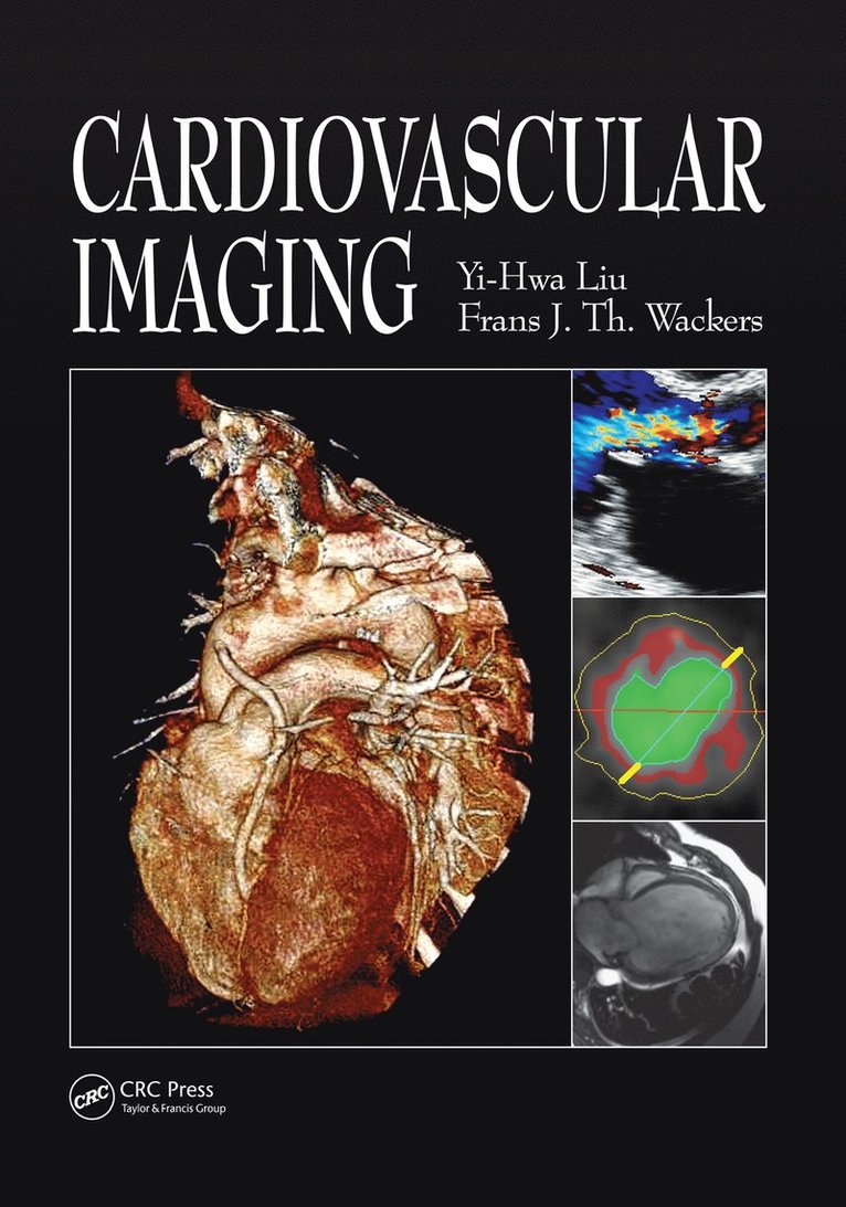 Yi-Hwa Liu, Frans Wackers, USA) Liu, Yi-Hwa (Yale University School of Medicine, New Haven, Connecticut, USA) Wackers, Frans (Yale University School of Medicine, New Haven, Connecticut - Cardiovascular Imaging, Inbunden