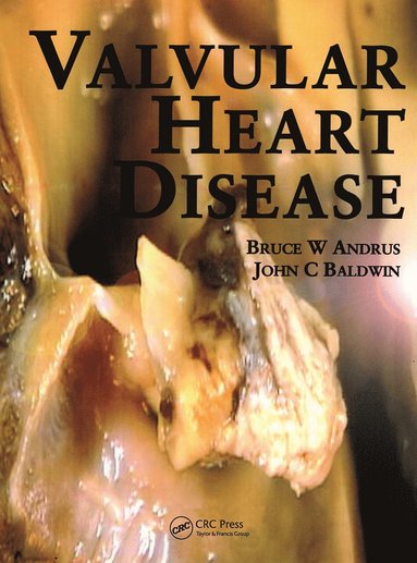 bokomslag Valvular Heart Disease