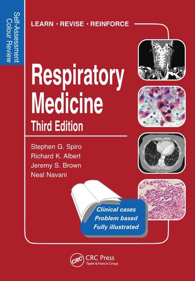 Stephen Spiro, Richard Albert, Jerry Brown, Neal Navani - Respiratory Medicine, Häftad