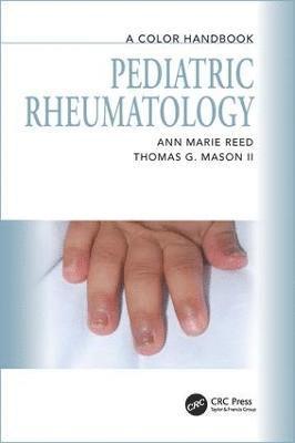 Pediatric Rheumatology 1