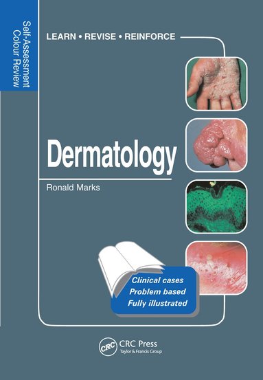 Ronald Marks - Dermatology, Häftad