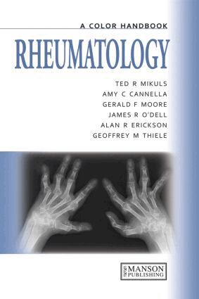 Ted Mikuls, Gerald Moore, Geoffrey Thiele, James O'Dell, Alan Erikson, Amy Cannella - Rheumatology, Häftad