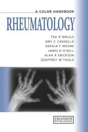 Ted Mikuls, Gerald Moore, Geoffrey Thiele, James O'Dell, Alan Erikson, Amy Cannella - Rheumatology, Häftad