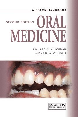 Oral Medicine, Second Edition