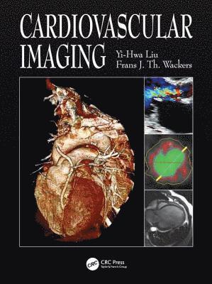 bokomslag Cardiovascular Imaging