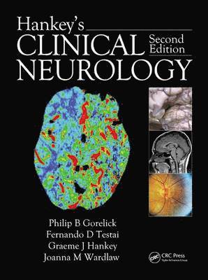 Hankey's Clinical Neurology 1