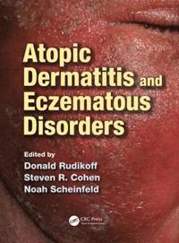 bokomslag Atopic Dermatitis and Eczematous Disorders