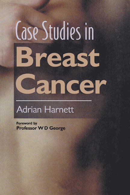 Adrian Harnett - CASE STUDIES IN BREAST CANCER, Inbunden
