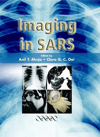 bokomslag Imaging in SARS