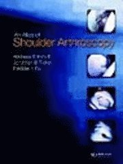 bokomslag Atlas of Shoulder Arthroscopy