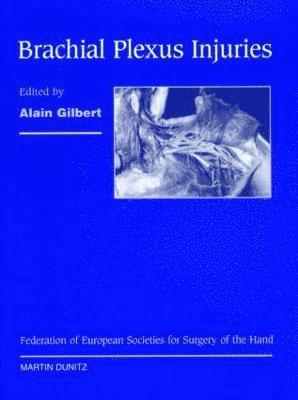 Brachial Plexus Injuries 1