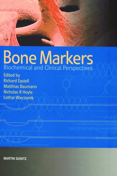 Matthias Baumann, Richard Eastell, Nicholas Hoyle, Lothar Wieczorek - Bone Markers, Inbunden