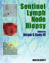 bokomslag Sentinel Lymph Node Biopsy
