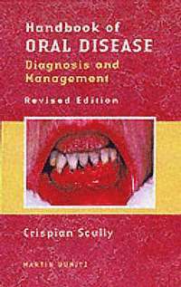 bokomslag Handbook of Oral Disease