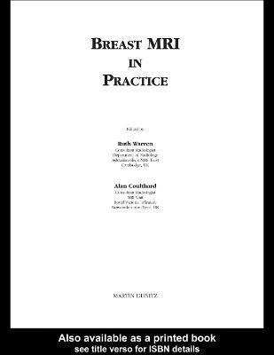 Breast MRI in Practice 1