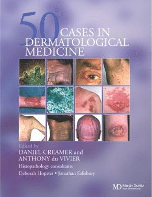 bokomslag Fifty Dermatological Cases