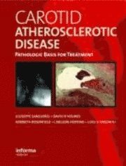 bokomslag Carotid Atherosclerotic Disease