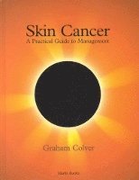 Skin Cancer 1