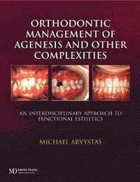 bokomslag Orthodontic Management of Agenesis and Other Complexities