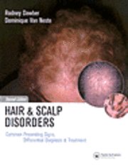 bokomslag Hair and Scalp Disorders