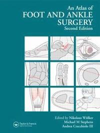 bokomslag Atlas Foot and Ankle Surgery