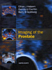 bokomslag Imaging of the Prostate