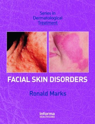 Ronald Marks - Facial Skin Disorders, Inbunden