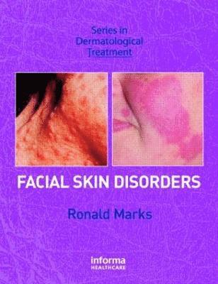 Facial Skin Disorders 1