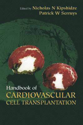 Handbook of Cardiovascular Cell Transplantation 1