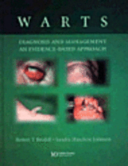 Warts 1