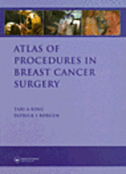 bokomslag Atlas of Procedures in Breast Cancer Surgery