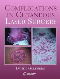bokomslag Complications in Laser Cutaneous Surgery