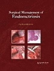 bokomslag Surgical Management Of Endometriosis